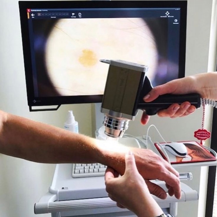Digitale Dermatoskopie